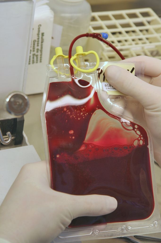 Nesmrtelnost pupečníkové krve, pomůže i desítky let po zamrazení